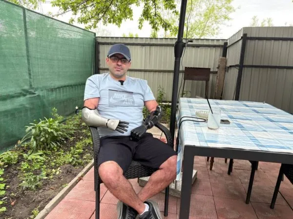 «Мріяв ніколи не працювати руками — мрія збулася»: ветеран із Бердичева отримав протези ціною у два джипи
