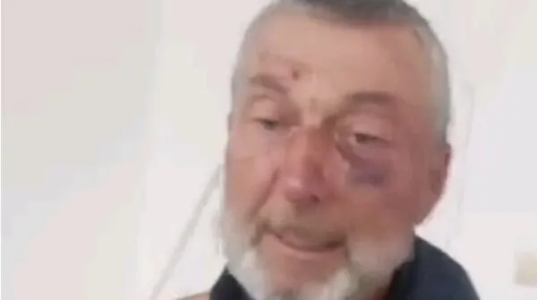 На Рівненщині працівники ТЦК жорстоко побили 61-річного ветерана-афганця: чоловік у реанімації